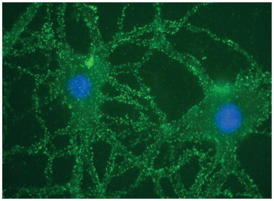 Neurony w hodowli komórkowej – jasnozielone kropki to miejsca, w których przeciwciała związały się z receptorami NMDA; http://www.ncbi.nlm.nih.gov/pmc/articles/PMC3707140/