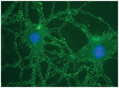 Neurony w hodowli komórkowej – jasnozielone kropki to miejsca, w których przeciwciaa zwizay si z receptorami NMDA; http://www.ncbi.nlm.nih.gov/pmc/articles/PMC3707140/