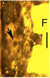F. Gonopore (arrow) on ventral sternite. (Female genitalia). Scale bar is 130 microns (0.13 mm)