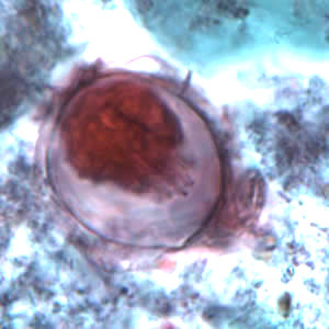 Jajko tasiemca karowatego w próbce stolca; Oregon State Public Health Laboratory; http://www.cdc.gov/dpdx/hymenolepiasis/gallery.html#hnanaeggsPVA