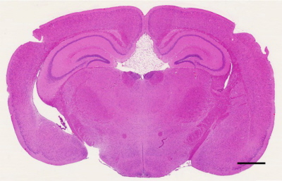 Przekrój przez mózgowie myszy laboratoryjnej; w samym mniej wicej rodku tuszczak o trójktnym zarysie; CC-BY, http://www.ncbi.nlm.nih.gov/pmc/articles/PMC3392903/