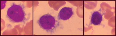 Komórki biaaczki wochatokomórkowej; CC BY-NC-ND 4.0 http://www.ncbi.nlm.nih.gov/pmc/articles/PMC4382572/