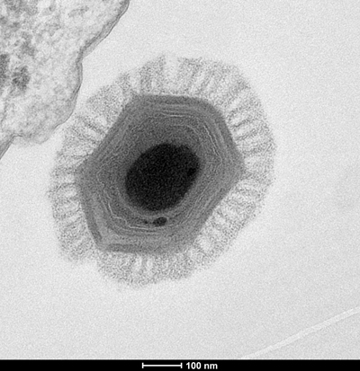 Megavirus chilensis; Chantal Abergel; CC BY-SA 3.0