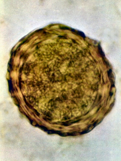 Jajeczko glisty ludzkiej; GrahamColm, Wikipedia, CC BY-SA 3.0