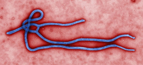 Wirus Eboli. Micrograph z CDC/Cynthia Goldsmith