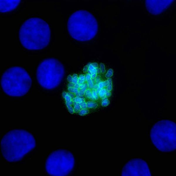 Niebieskie chromosomy w dzielcej si komórce ródbonka, a wokó kadego z nich zielonkawa otoczka z Ki-67; Zhiguo.he, Wikipedia, CC BY-SA 4.0
