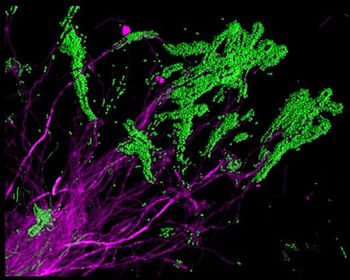 Spoeczno mikrobiomu kamienia nazbnego. Zdjcie: Mark Welch et al, PNAS, 2016.