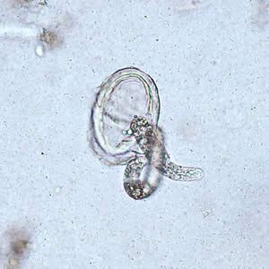 Larwa wykluwa si z jajeczka; CDC, http://www.cdc.gov/dpdx/ascariasis/gallery.html#larvaehatching