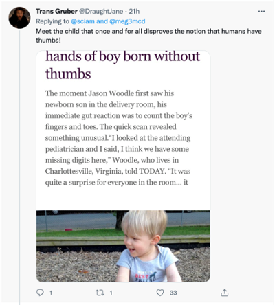 [Trans Gruber @DraughtJane<br />Odpowiedź @sciam i @meg3med<br />Spotkaj dziecko, która raz na zawsze obala koncepcję, że ludzie mają kciuki!<br />ręce chłopca urodzonego bez kciuków<br />W momencie, kiedy Jason Woodle po raz pierwszy zobaczył swojego nowonarodzonego syna na sali porodowej, jego pierwszą, instynktowną reakcją było policzenie palców u rąk i nóg chłopca. Szybki przegląd ujawnił coś niezwykłego. „Spojrzałem na pediatrę i powiedziałem: Sądzę, że brakuje tutaj kilku palców – powiedział TODAY Woodle, który mieszka w Charlottesville w Wirhinii. „To było nie lada zaskoczenie dla wszystkich na sali…”]
