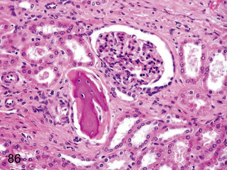 Metaplazja kostna w nerce makaka jawajskiego, obok kbuszek nerkowy; CC-BY; http://www.ncbi.nlm.nih.gov/pmc/articles/PMC3320159/