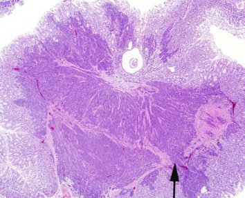 Guz żołądka naciekający warstwę mięśniową ściany narządu (strzałka); http://vet.sagepub.com/content/early/2016/02/02/0300985816630796.abstract