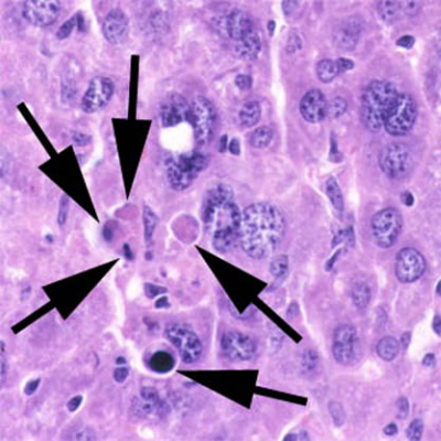 Ciaka apoptotyczne, wtroba; domena publiczna, NIH, https://en.wikipedia.org/wiki/Apoptosis#/media/File:Apoptosis_multi_mouseliver.jpg