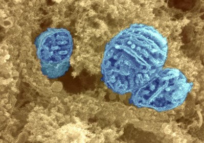Trzy wybarwione na niebiesko mitochondria (mikroskop elektronowy); Credit: Dr David Furness. Wellcome Images; CC BY-NC-ND 2.0 