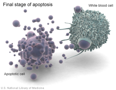 Po lewej apoptotyczne bbelki, po prawej poerajca je biaa krwinka; U.S. National Library of Medicine, domena publiczna, https://ghr.nlm.nih.gov/gallery