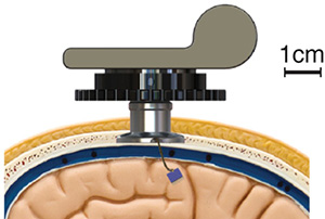 Yin et al Neuron 2014 http://dx.doi.org/10.1016/ j.neuron.2014.11.010