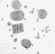 Historyczna ilustracja – Sarcina vemtriculi (a) w treci wymiotnej; http://chestofbooks.com/health/disease/Pathology-2/1-Sarcina.html