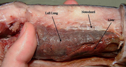 <br />Struna grzbietowa (ang. notochord) ryby dwudysznej; Wikipedia; Mokele, CC-BY-SA-3.0, GNU Free Documentation License