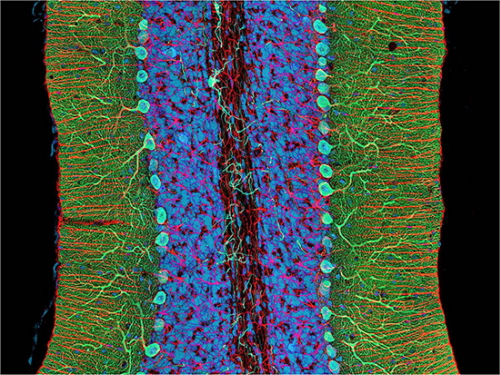 Thomas Deerinck, National Center for Microscopy and Imaging Research, University of California, San Diego