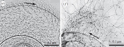 <span>Po lewej: Kolce na penisie limaka nagoskrzelnego. Po prawej: plemniki wpltane w kolce. Z Sekizawa et al., Biology Letters</span>