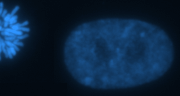 Niejednorodna, nieco ziarnista, struktura chromatyny jdra komórkowego pomidzy podziaami, po lewej widoczny fragment dzielcego si jdra ssiedniej komórki z wyranie widocznymi chromosomami; JamMan, Wikipedia, domena publiczna.