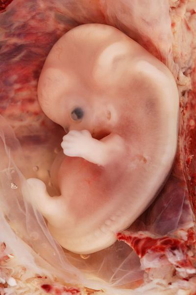Dziewity tydzie ciy uwaany za graniczny dla wczesnej aborcji farmakologicznej; Ed Uthman; CC-BY-SA 2.0
