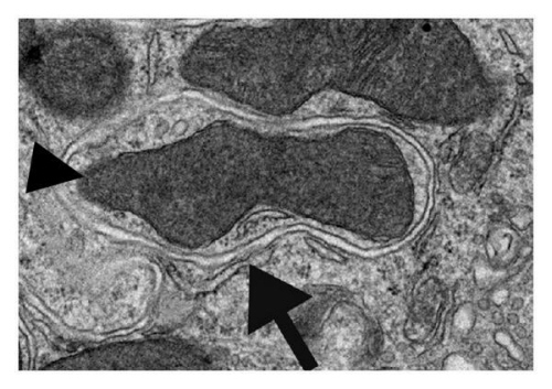 Mitofagia – mitochondrium niszczone wewntrz wewntrzkomórkowego pcherzyka trawiennego; G Mitou et al, CC BY 3.0; http://www.hindawi.com/journals/ijpg/2009/451357/