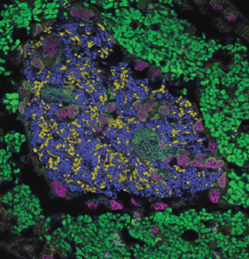 Dwa gatunki Hodgkinii (niebieskie i óte kropki) w komórkach cykady. Zdjcie: Van Leuven et al, 2014.