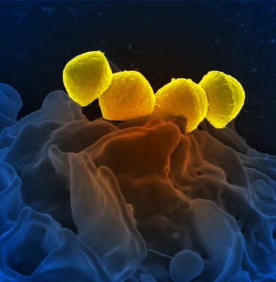 Bakterie Streptococcus pyogenes na powierzchni biaej krwinki; mikroskop elektronowy; NIH; https://commons.wikimedia.org/wiki/File:Streptococcus_pyogenese_Bacteria.jpg