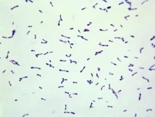 Maczugowce bonicy (Corynebacterium diphtheriae); CDC, Graham Heid, domena publiczna; https://phil.cdc.gov/Details.aspx?pid=12163