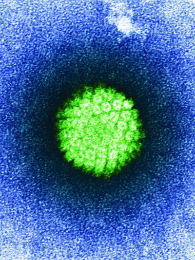 A to HPV wanie; http://www.ncbi.nlm.nih.gov/pmc/articles/PMC1678810/