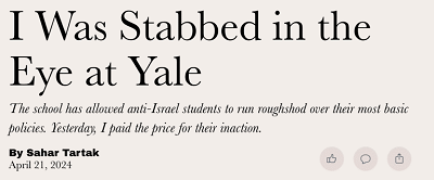 https://www.thefp.com/p/i-was-stabbed-in-the-eye-at-yale