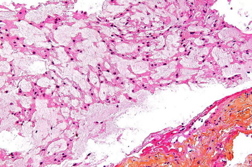 Obraz mikroskopowy struniaka; Wikipedia, Nephron; CC BY-SA 3.0