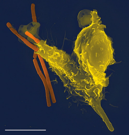 Biaa krwinka (neutrofil, granulocyt obojtnochonny) fagocytujcy bakterie wglika (pomaraczowe); CC BY 2.5; http://www.plospathogens.org/article/browseIssue.action?issue=info%3Adoi%2F10.1371%2Fissue.ppat.v01.i03