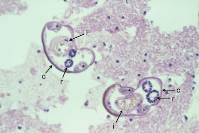 Przekrój larw A. cantonensis w rdzeniu krgowym (c- oskórek, i – jelito, r – sznury pciowe); https://www.ncbi.nlm.nih.gov/pmc/articles/PMC4312175/