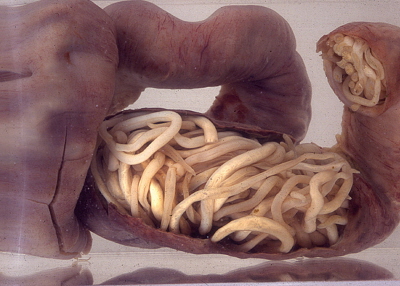 Fragment jelita trzyletniego chopca operowanego z powodu niedronoci (dziecko przeyo); fot. Allen Jefthas, dziki South African Medical Research Council; CC BY 2.0, https://www.flickr.com/photos/gtzecosan/16424898321/