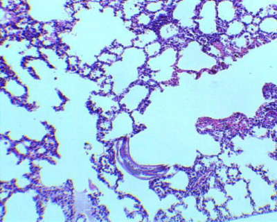 Larwa glisty (póksiycowata, porodku dolnej poówki zdjcia) w pucu; California University of Pennsylvania, http://workforce.calu.edu/Buckelew/Ascaris%20lumbricoides%20larvae.htm