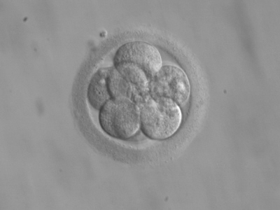8-komórkowa morula; RWJMS IVF Program; domena publiczna