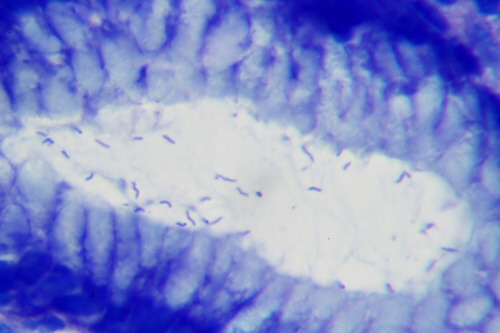 Wybarwione na niebiesko bakterie Helicobacter pylori wewntrz cewy gruczoowej w odku; Patho, Wikipedia, CC BY-SA 3.0