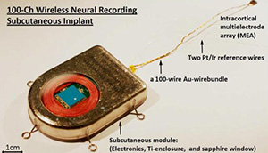 Yin et al IEEE Trans Biomed Circuits Syst. Apr 2013; 7(2): 115–128. doi: 10.1109/TBCAS.2013.2255874