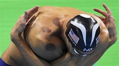 lady po bakach widoczne na ciele pywaka amerykaskiego Michaela Phelpsa (Zdjcie: Al-mlab.com, 11 sierpnia 2016)