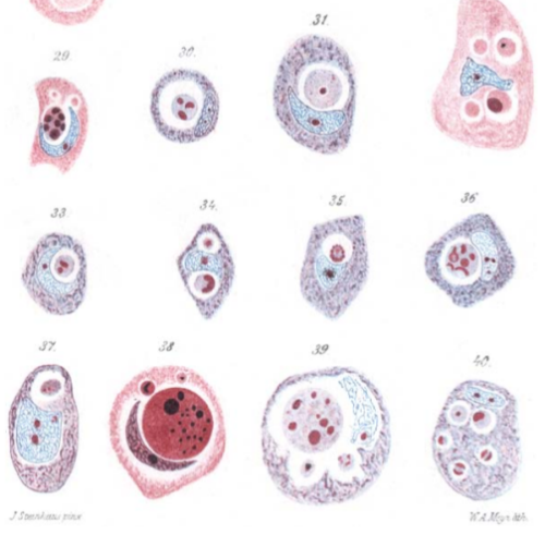 Ilustracje z pracy Steinhausa z 1891 roku przedstawiajce komórki wchonite przez komórki nowotworowe; http://link.springer.com/article/10.1007/BF01937613