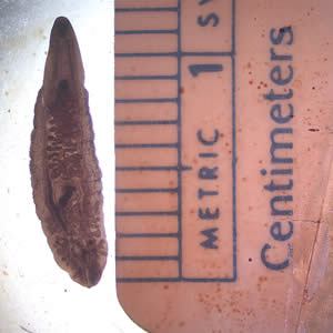 Dorosa przywra chiska; domena publiczna, http://www.cdc.gov/dpdx/clonorchiasis/index.html