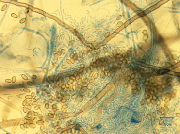 <span>Hodowle mikrobiologiczne troch trway, efekty jednak byy tego warte; CC BY-NC-ND 4.0, </span>https://www.ncbi.nlm.nih.gov/pmc/articles/PMC4398817/