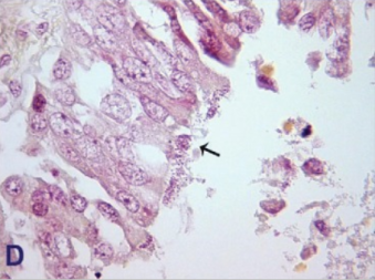 Masy bakterii na powierzchni pozostaoci nabonka oddechowego; CC-BY, https://www.ncbi.nlm.nih.gov/pmc/articles/PMC4584670/
