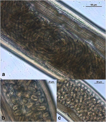Poszczególne rejony robaczej macicy zawierajce larwy oraz mniej i bardziej dojrzae jaja; CC BY 4.0, https://www.ncbi.nlm.nih.gov/pmc/articles/PMC5390348/