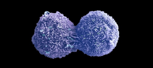 Dividing lung cancer cell. Photo by Anne Weston, LRI, CRUK, Wellcome Images
