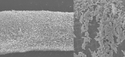 Bakterie pokrywajce gstym kouszkiem ciao robaka; z prawej – z bliska; CC BY 3.0; http://www.ncbi.nlm.nih.gov/pmc/articles/PMC3898767/