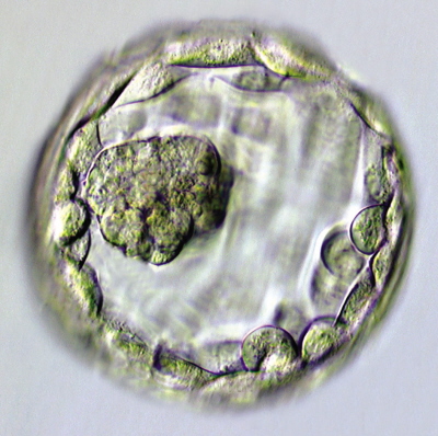 Ludzka blastula, blastocysta; Mr. J. Conaghan; domena publiczna; wikipedia