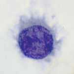 Włochaty limfocyt; CS99, wikipedia, domena publiczna