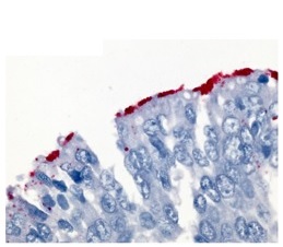 Wybarwione odpowiednimi przeciwciaami na czerwono paeczki krztuca na powierzchni nabonka oddechowego; https://www.ncbi.nlm.nih.gov/pmc/articles/PMC3723573/